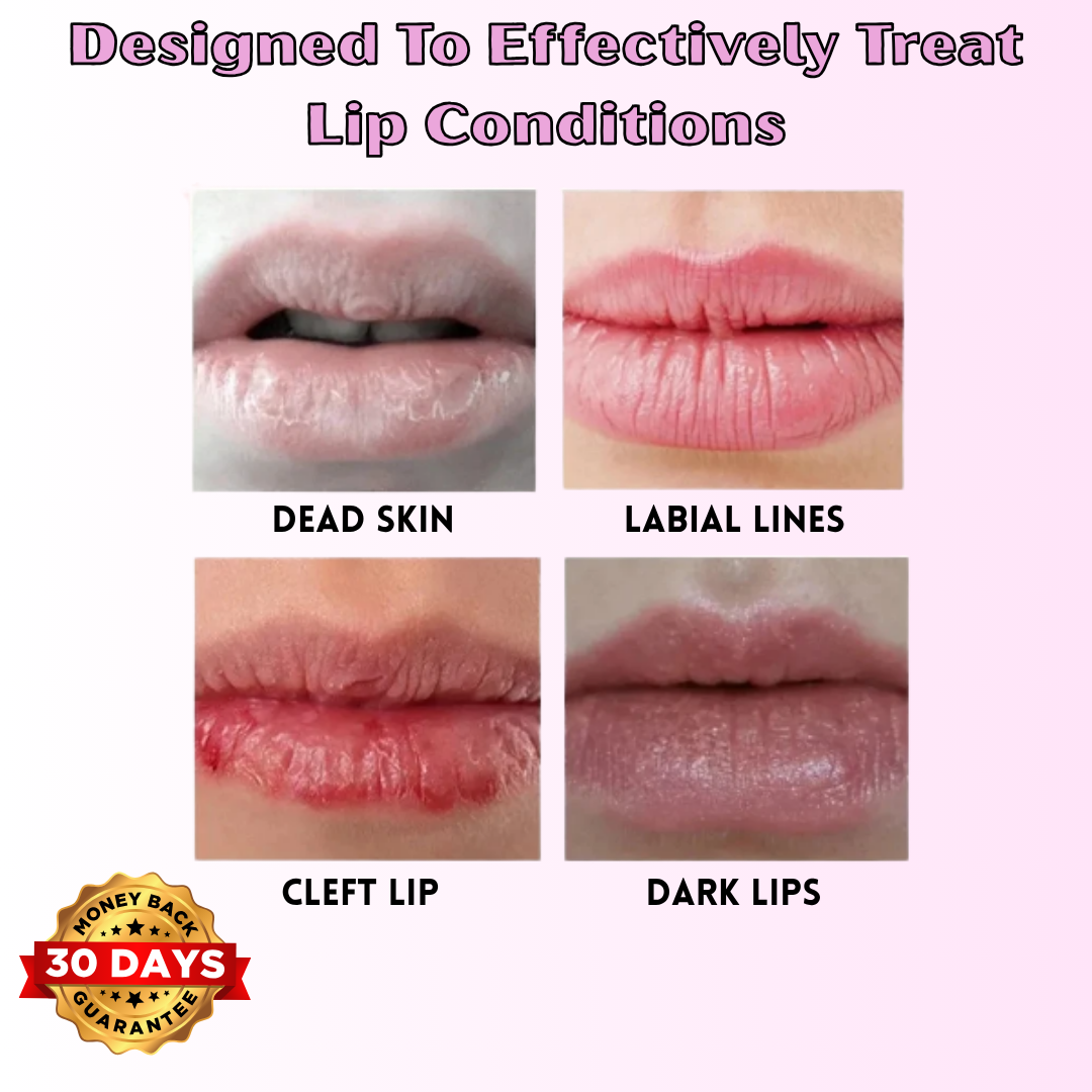 DermaLyft™ - Serum-Infusing Lip Roller