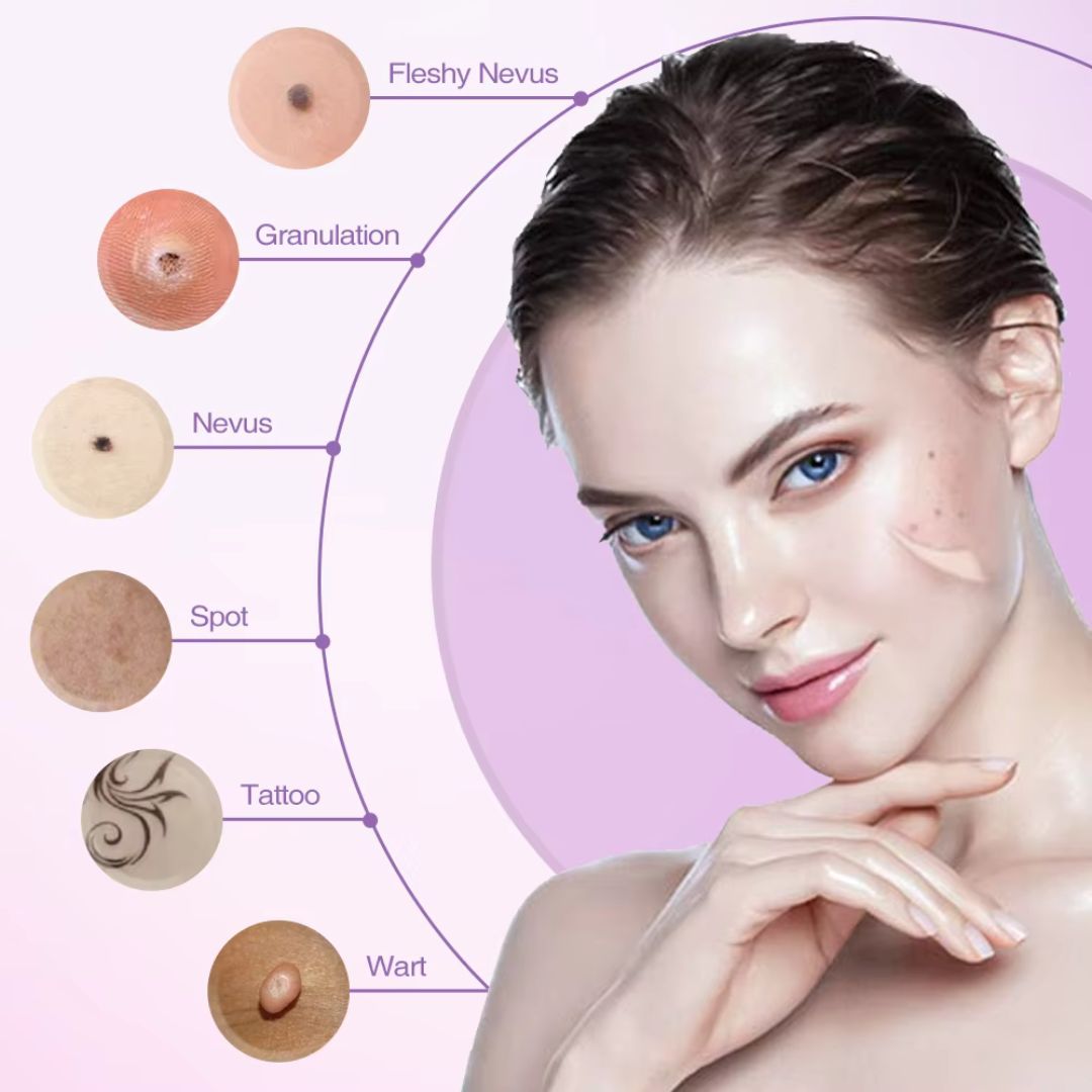 Tattoo Mole Removal Plasma Pen Laser Facial Freckle Dark Spot Remover Tool Wart Removal Machine Face Skin Care Beauty Device